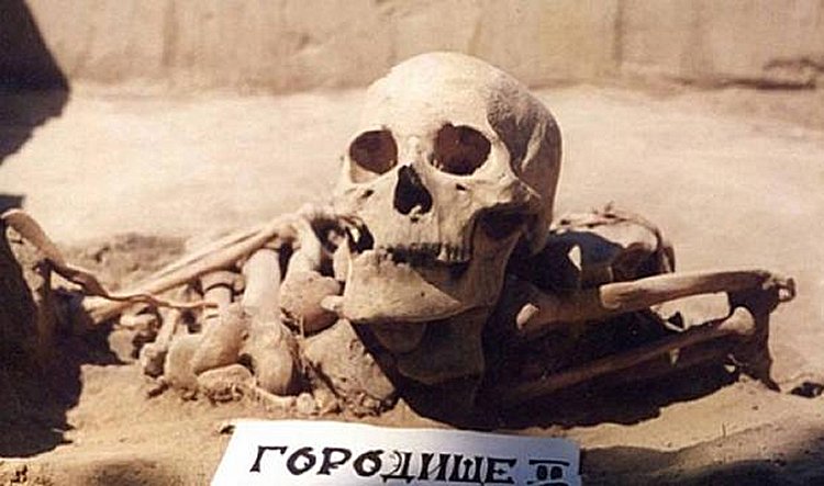Oldest case of leukemia found on 7,000-Year-old skeleton