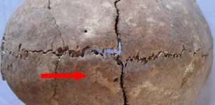 Skull with traces of healed trauma (the arrow) from Tell Majnuna, Syria, late Chalcolithic (c. 3500 BC). Photo by A. Sołtysiak