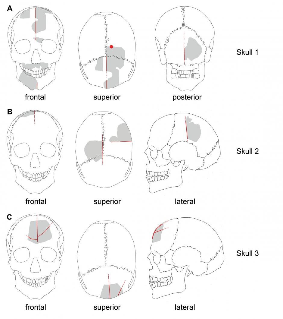 Mysterious Skull Cult At Göbekli Tepe - Ancestor Worship Or Trophies Of Dead Enemies?