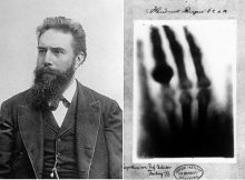 Left: Wilhelm Conrad Röntgen; Right: First medical X-ray by Wilhelm Röntgen of his wife Anna Bertha Ludwig's hand. Image: wikipedia