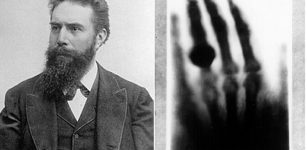 Left: Wilhelm Conrad Röntgen; Right: First medical X-ray by Wilhelm Röntgen of his wife Anna Bertha Ludwig's hand. Image: wikipedia