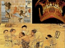 ancient history of dentistry