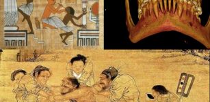 ancient history of dentistry