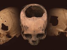 Ancient Peruvian brain Surgery