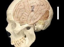 New Genes May Explain Why Humans Got Such Big Brains