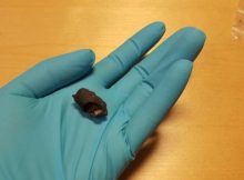 Oldest Scandinavian DNA Found In Ancient Chewing Gum