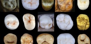 Dental morphology. Photo credit: Aida Gómez-Robles