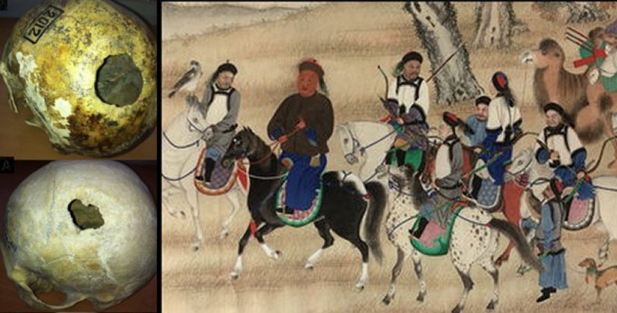 Siberia Had A Major Skull Surgery Center 2,500 Years Ago