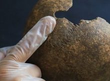Skull found at ancient site in southern Turkey shows neurosurgery performed 2,200 years ago
