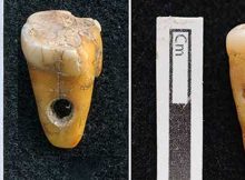 Rare Discovery Of 8,500-Year-Old Human Teeth Used As Jewelry