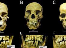 African skeletons from early colonial Mexico