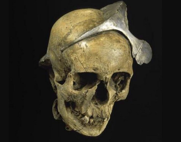 Woman skull with a silver diadem, El Argar, Spain (Bronze Age, 3rd millenium B.C. Cinquantenaire Museum, Brussels.
