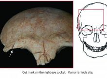 The trauma is slightly healed. However, because it seems to have been severe enough to have caused terrible damage to the person, it is likely perimortem. Credit: Chikushino City Board of Education