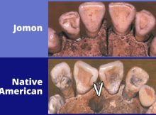 Jomon teeth vs Native American teeth. Credit: G. Richard Scott, University of Nevada Reno