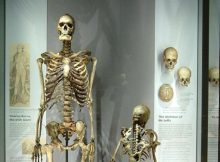 Skeleton Of Irish Giant Charles Byrne Will Not Be Displayed In The Hunterian Museum In London