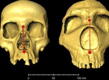 Nose Shape Gene Inherited From Neanderthals