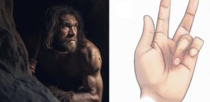 'Viking Disease' Hand Disorder May Come From Neanderthal Genes