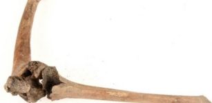 How Individuals With Disabilities Were Treated During The Late Middle Ages - Advanced Techniques Give Answers