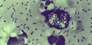 Large-Scale DNA Study Traces 37,000 Years of Disease History