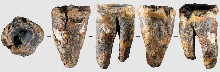 World's Oldest Successful Dental Treatment Found In 60,000-Year-Old Neanderthal Tooth From Chagyrskaya Cave