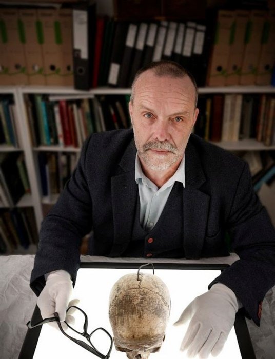 Medieval Scottish Crime Mystery Of The Cursed Skull Investigated By Forensic Experts Medieval Scottish Crime Mystery Of The Cursed Skull Investigated By Forensic Experts